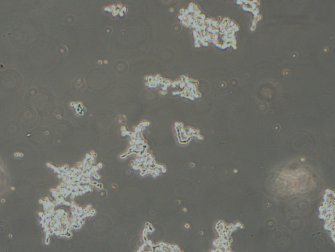 WERI-Rb-1人視網膜神經膠質瘤細胞（STR鑒定正確）