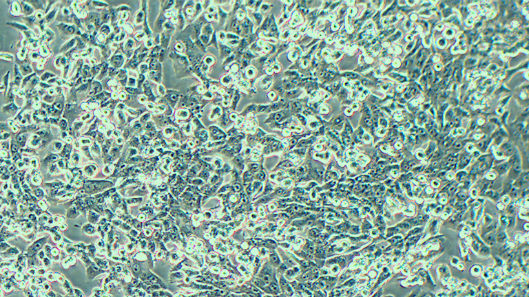 SK-HEP-1人肝腹水腺癌細胞（STR鑒定正確）