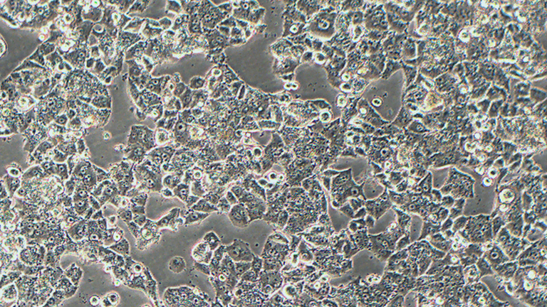 NCI-H1395人肺腺癌細(xì)胞（STR鑒定正確）