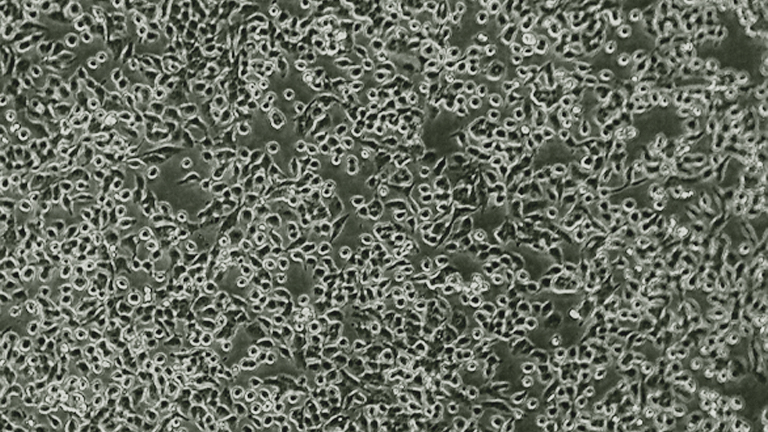 NCI-H3122人肺腺癌細胞（STR鑒定正確）