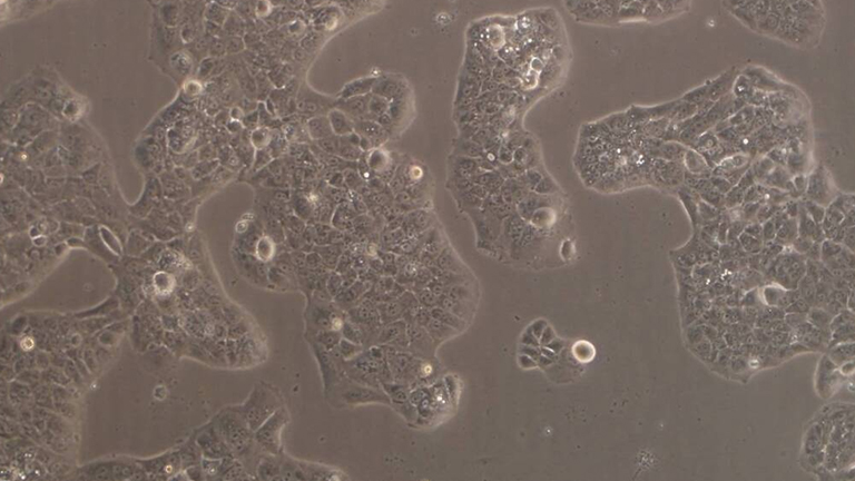 MS751人子宮頸表皮癌細(xì)胞（STR鑒定正確）