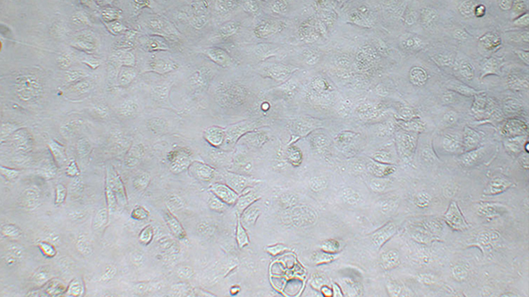 NCI-H661人大細(xì)胞肺癌細(xì)胞（STR鑒定正確）