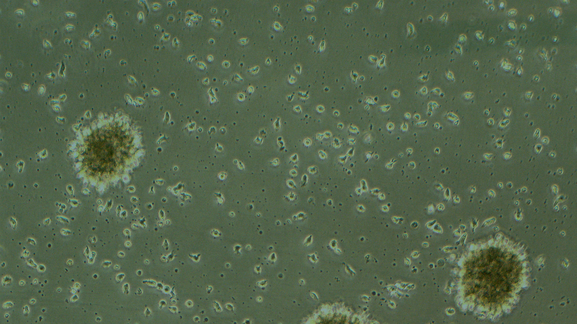 SMA1(GM23687) 人脊髓性肌萎縮癥淋巴細(xì)胞（STR鑒定正確）