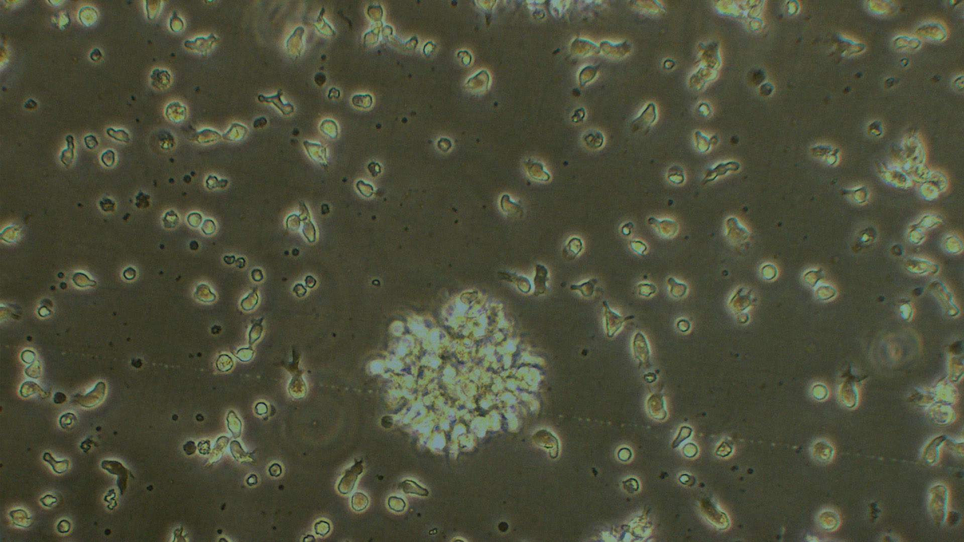 SMA3(GM23255) 人脊髓性肌萎縮癥淋巴細(xì)胞（STR鑒定正確）