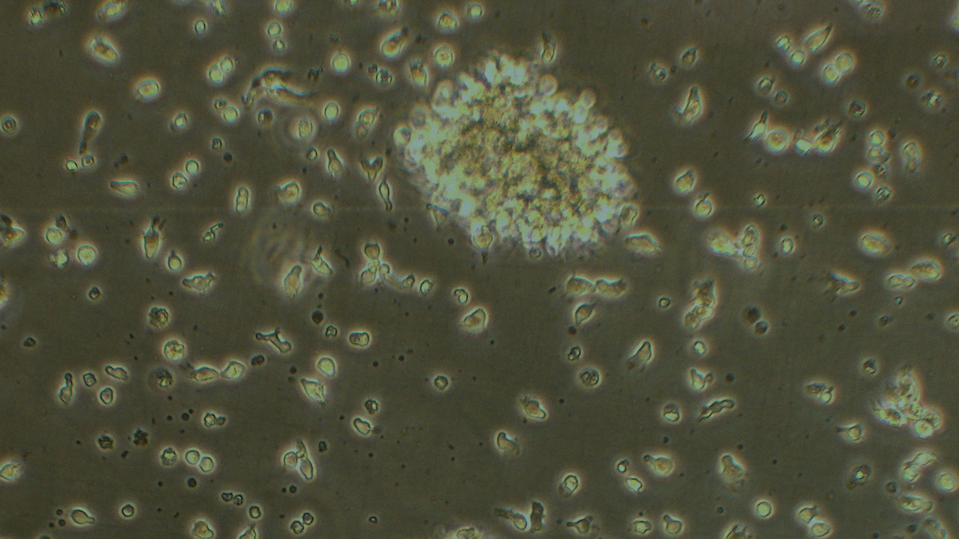 SMA1(GM10684) 人脊髓性肌萎縮癥淋巴細(xì)胞（STR鑒定正確）