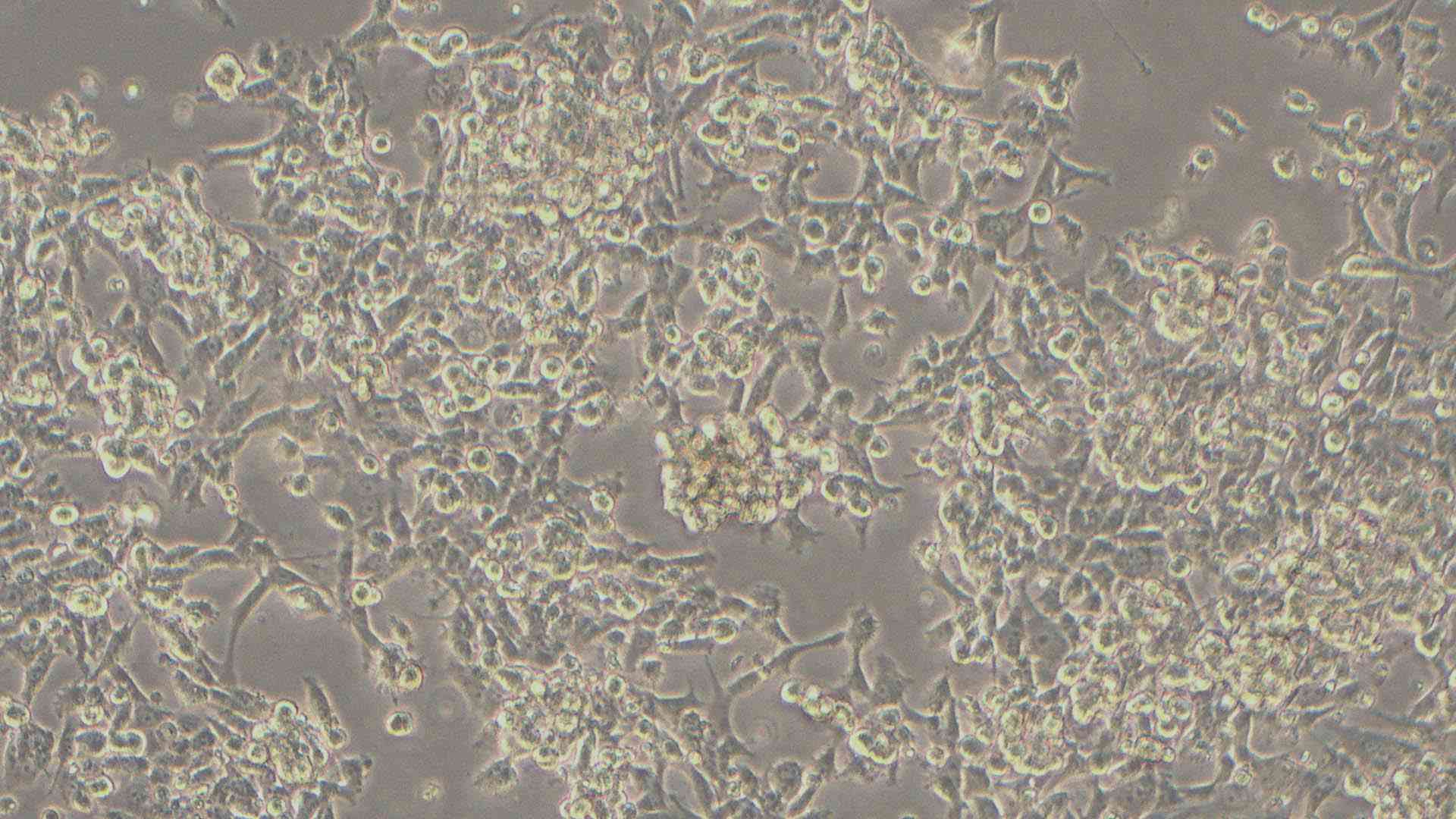 PLA-801D(95D)人高轉(zhuǎn)移肺腺癌細(xì)胞（STR鑒定正確）